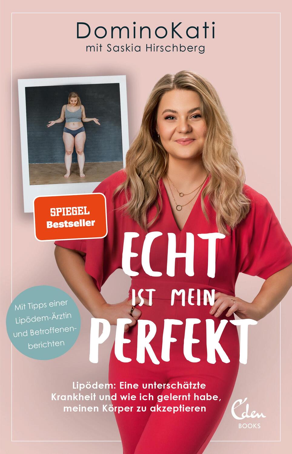 Cover: 9783959103664 | Echt ist mein Perfekt | DominoKati (u. a.) | Taschenbuch | 256 S.