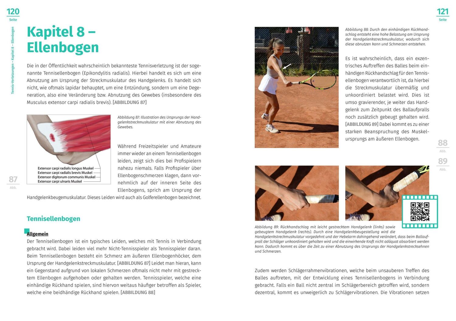 Bild: 9783964160645 | Tennis-Verletzungen | Peter Kaiser | Taschenbuch | 152 S. | Deutsch