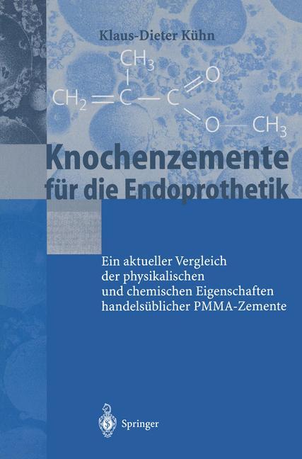 Cover: 9783540411826 | Knochenzemente für die Endoprothetik | K. -D. Kühn | Taschenbuch | xiv