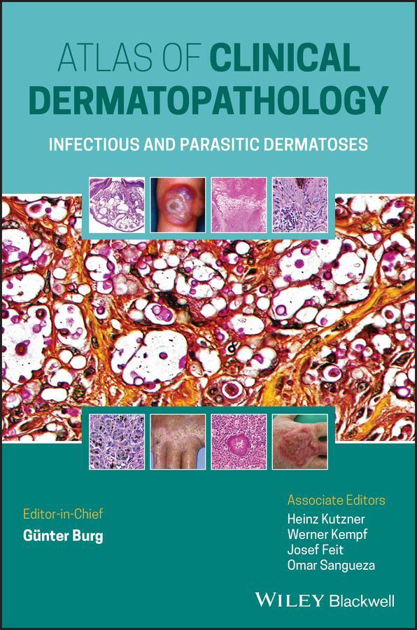 Cover: 9781119647065 | Atlas of Clinical Dermatopathology | Günter Burg | Buch | 208 S.