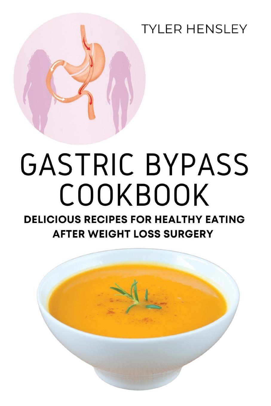 Cover: 9781803620619 | Gastric Bypass Cookbook | Tyler Hensley | Taschenbuch | Paperback