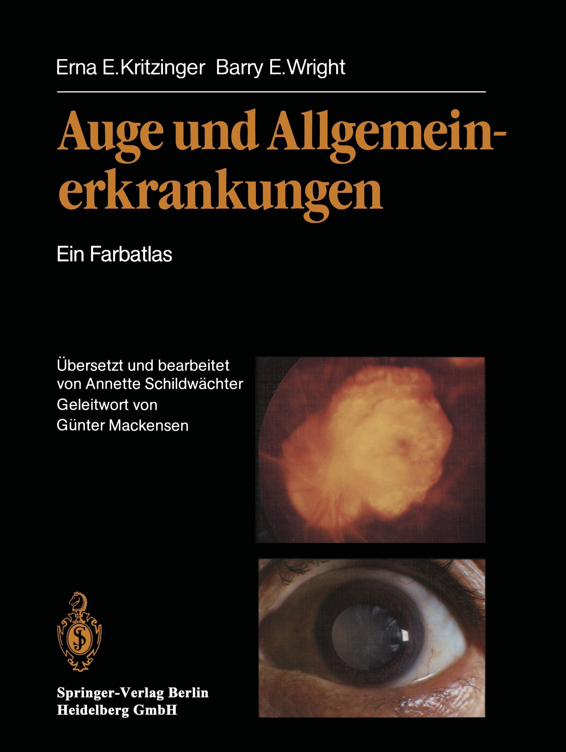 Cover: 9783642932946 | Auge und Allgemeinerkrankungen | Ein Farbatlas | Kritzinger (u. a.)