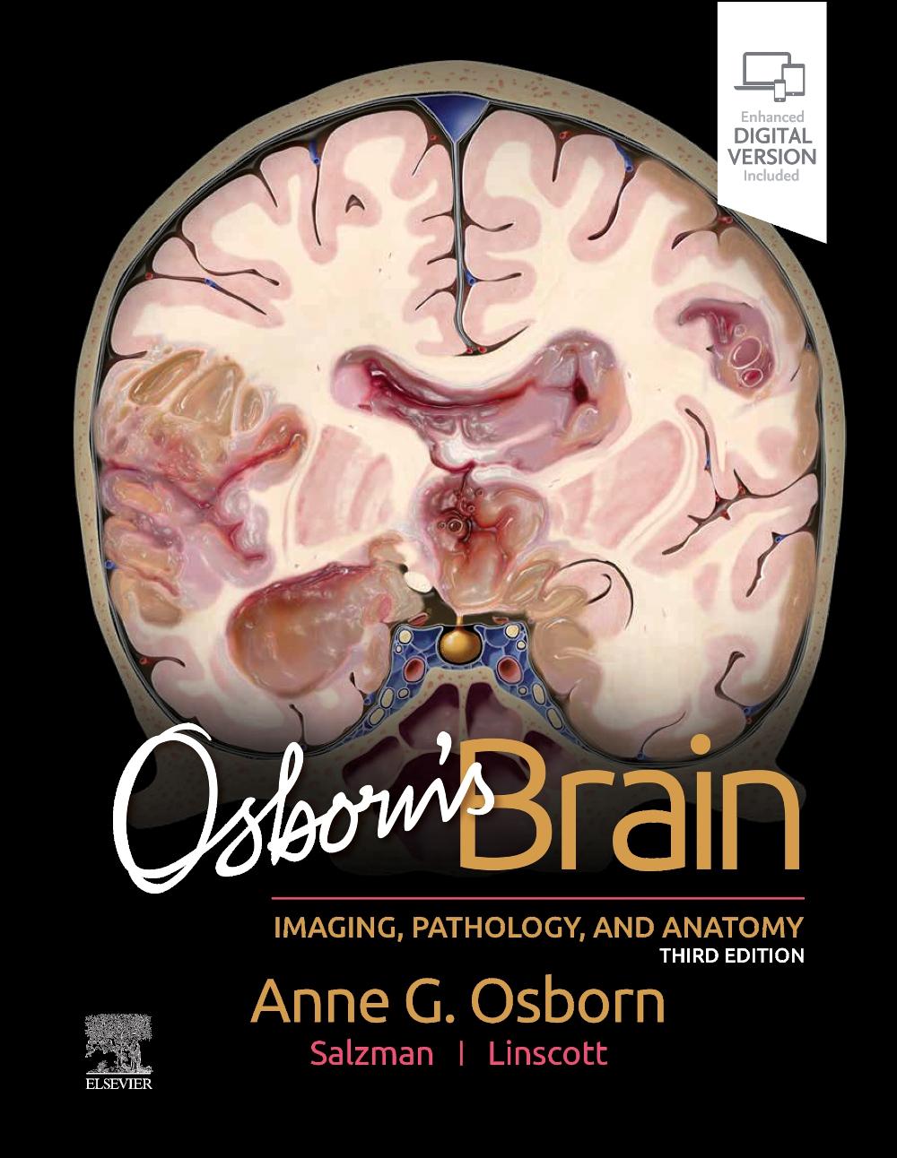 Cover: 9780443109379 | Osborn's Brain | Anne G. Osborn (u. a.) | Buch | Englisch | 2023