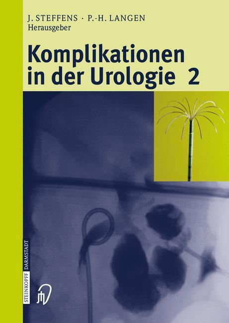 Bild: 9783798515437 | Komplikationen in der Urologie 2 | Band 2 | P. -H. Langen (u. a.) | xx