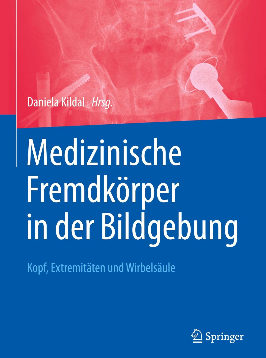 Cover: 9783662537497 | Medizinische Fremdkörper in der Bildgebung | Daniela Kildal | Buch