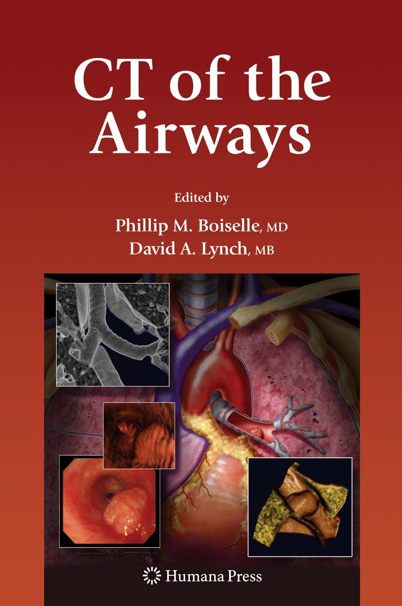 Cover: 9781588298485 | CT of the Airways | David Lynch (u. a.) | Buch | xiv | Englisch | 2008