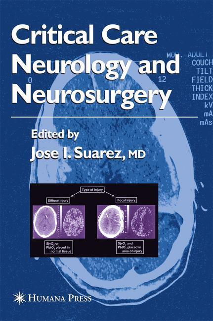 Cover: 9781588290892 | Critical Care Neurology and Neurosurgery | Jose I. Suarez | Buch | xv