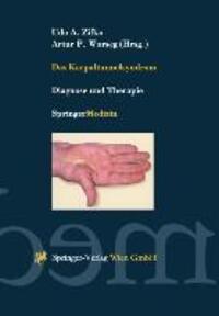 Cover: 9783211832141 | Das Karpaltunnelsyndrom | Diagnose und Therapie | Worseg (u. a.)