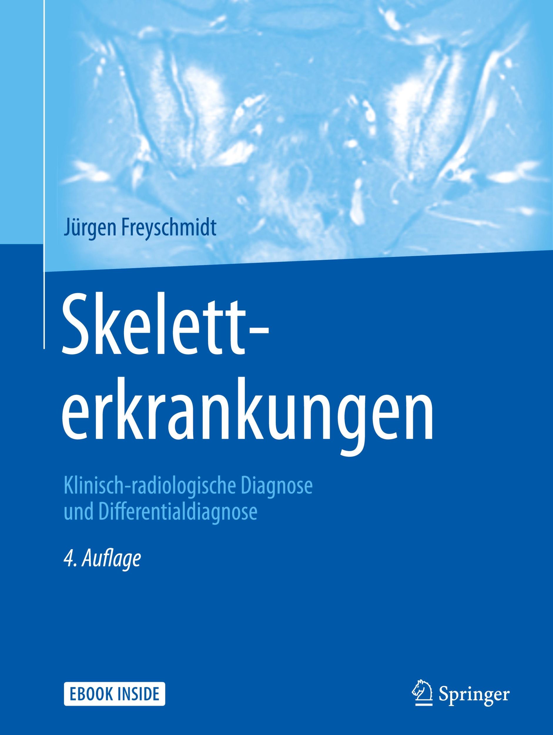 Cover: 9783662481363 | Skeletterkrankungen | Jürgen Freyschmidt | Buch | xiv | Deutsch | 2015