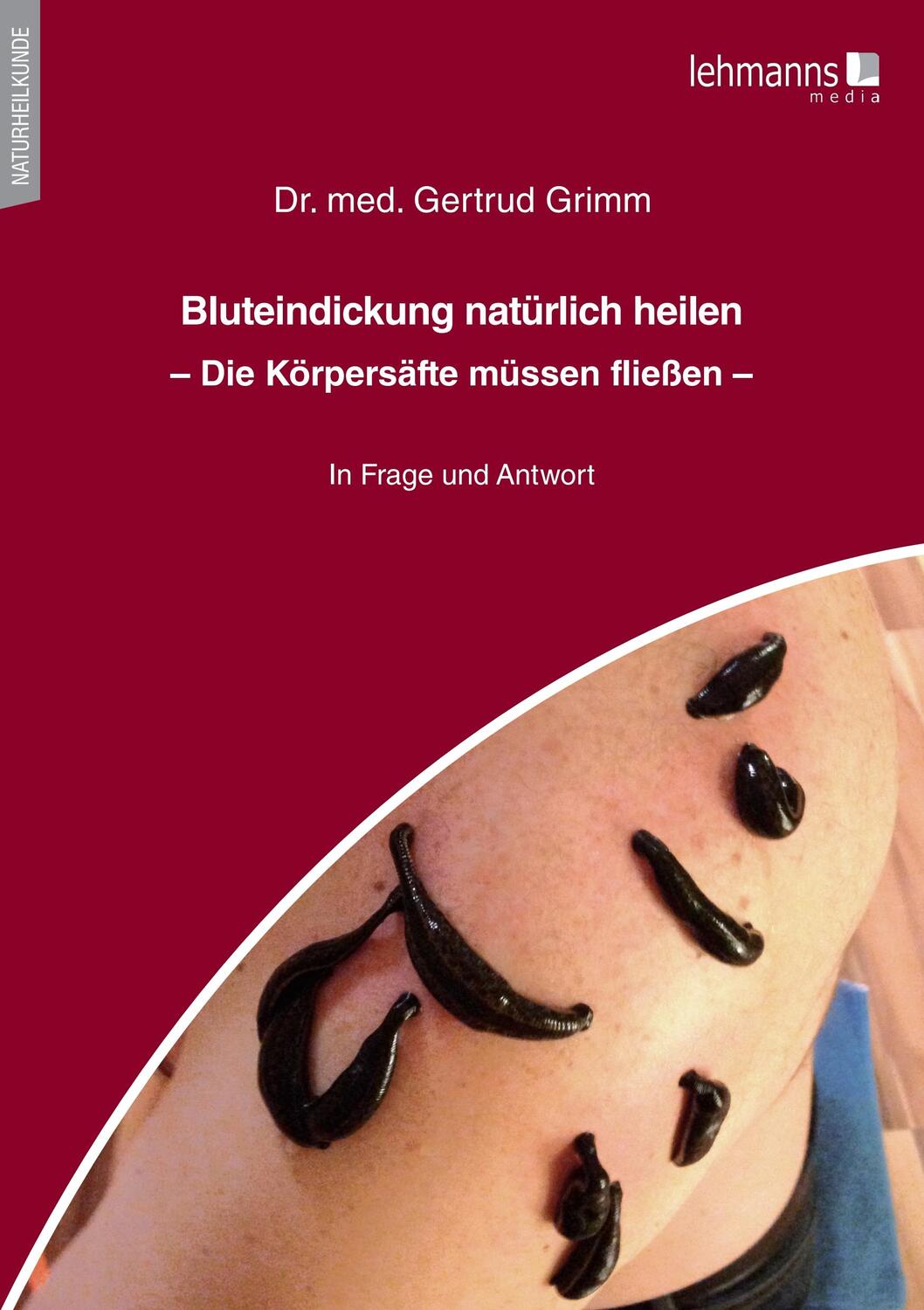 Cover: 9783965434028 | Bluteindickung natürlich heilen | Die Körpersäfte müssen fließen