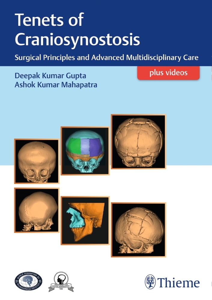 Cover: 9789386293565 | Tenets of Craniosynostosis | Deepak Gupta (u. a.) | Buch | Deutsch