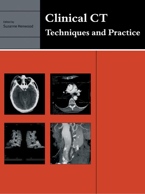 Cover: 9780521715089 | Clinical CT | Techniques and Practice | Suzanne Henwood | Taschenbuch