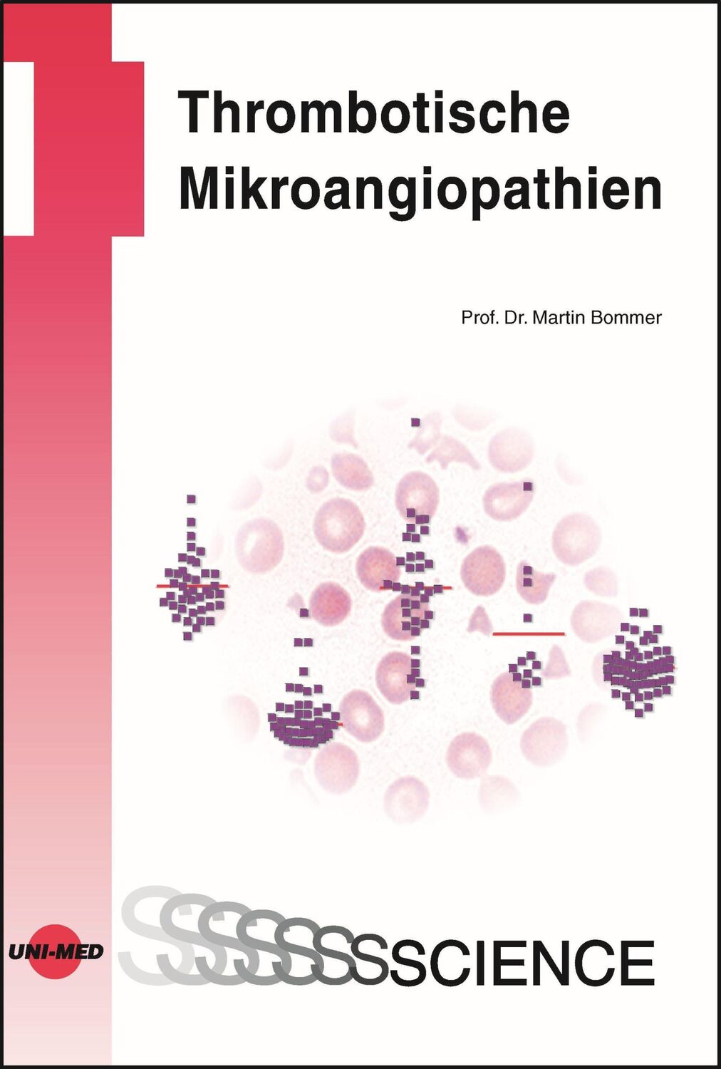 Cover: 9783837415933 | Thrombotische Mikroangiopathien | Martin Bommer | Buch | 47 S. | 2022