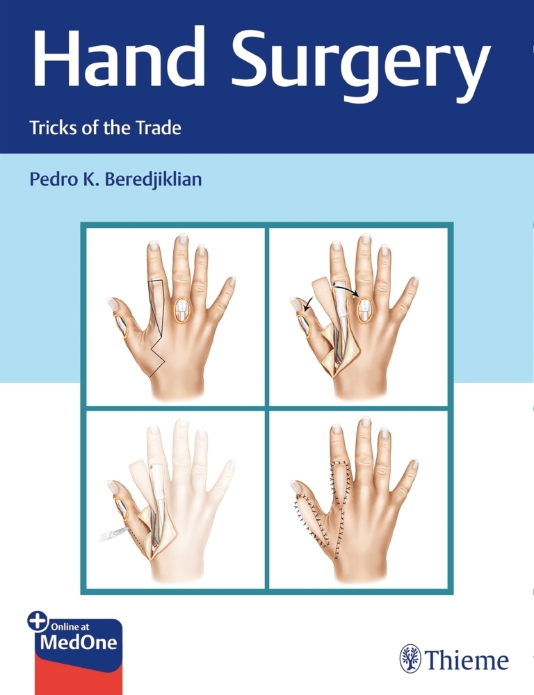 Cover: 9781626234796 | Hand Surgery | Tricks of the Trade. Plus Online at MedOne | Bundle