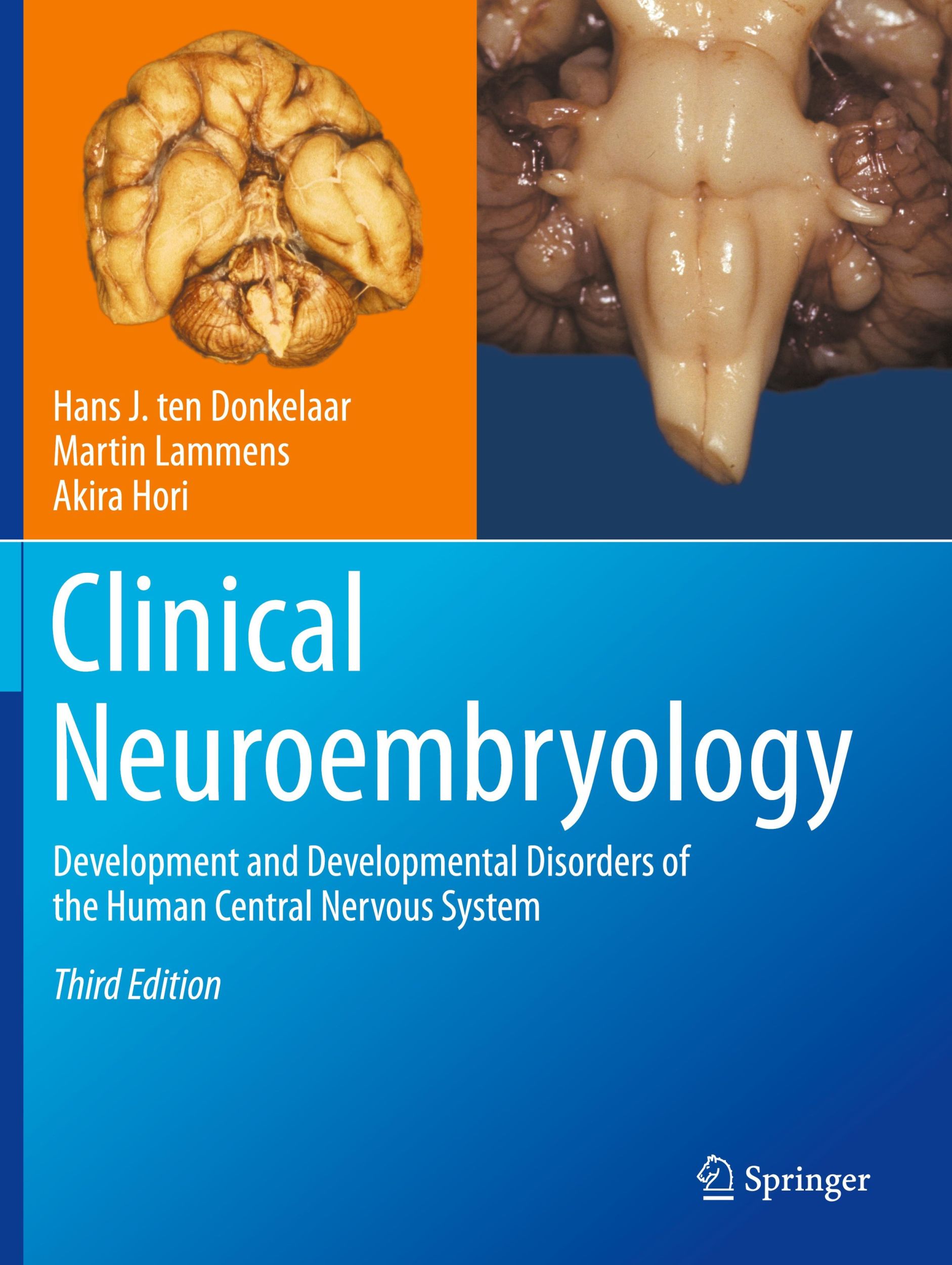 Cover: 9783031261008 | Clinical Neuroembryology | Akira Hori (u. a.) | Taschenbuch | xvi