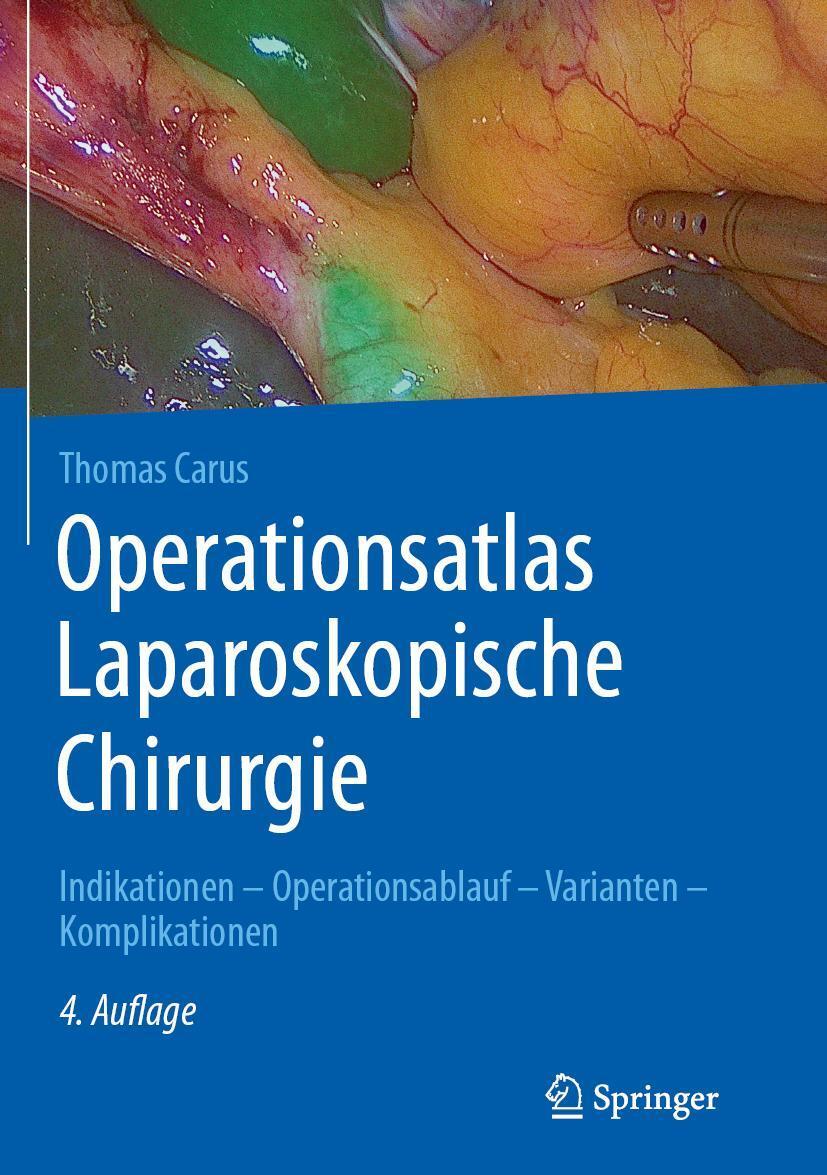 Cover: 9783662582381 | Operationsatlas Laparoskopische Chirurgie | Thomas Carus | Buch | xi