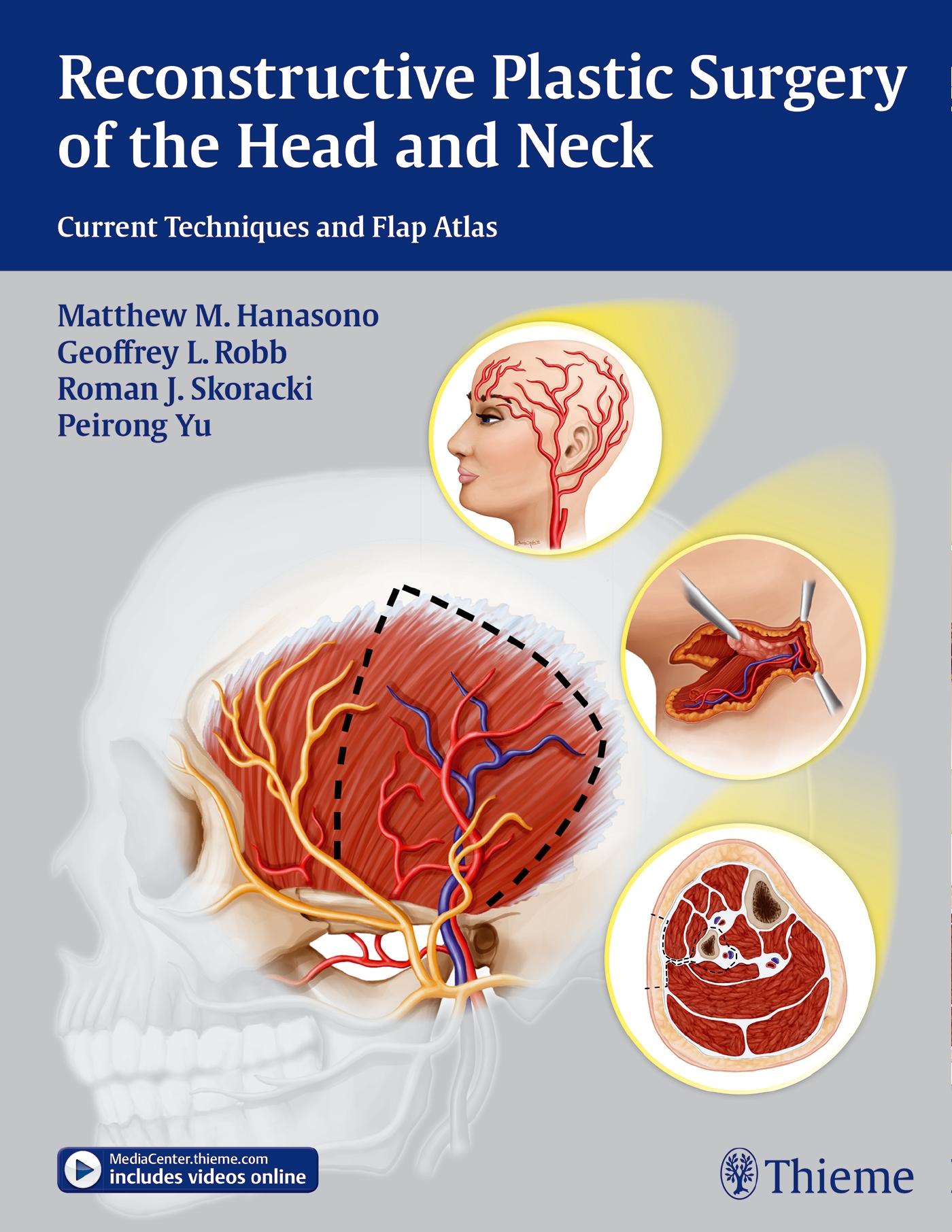 Cover: 9781604068078 | Reconstructive Plastic Surgery of the Head and Neck | Hanasono (u. a.)