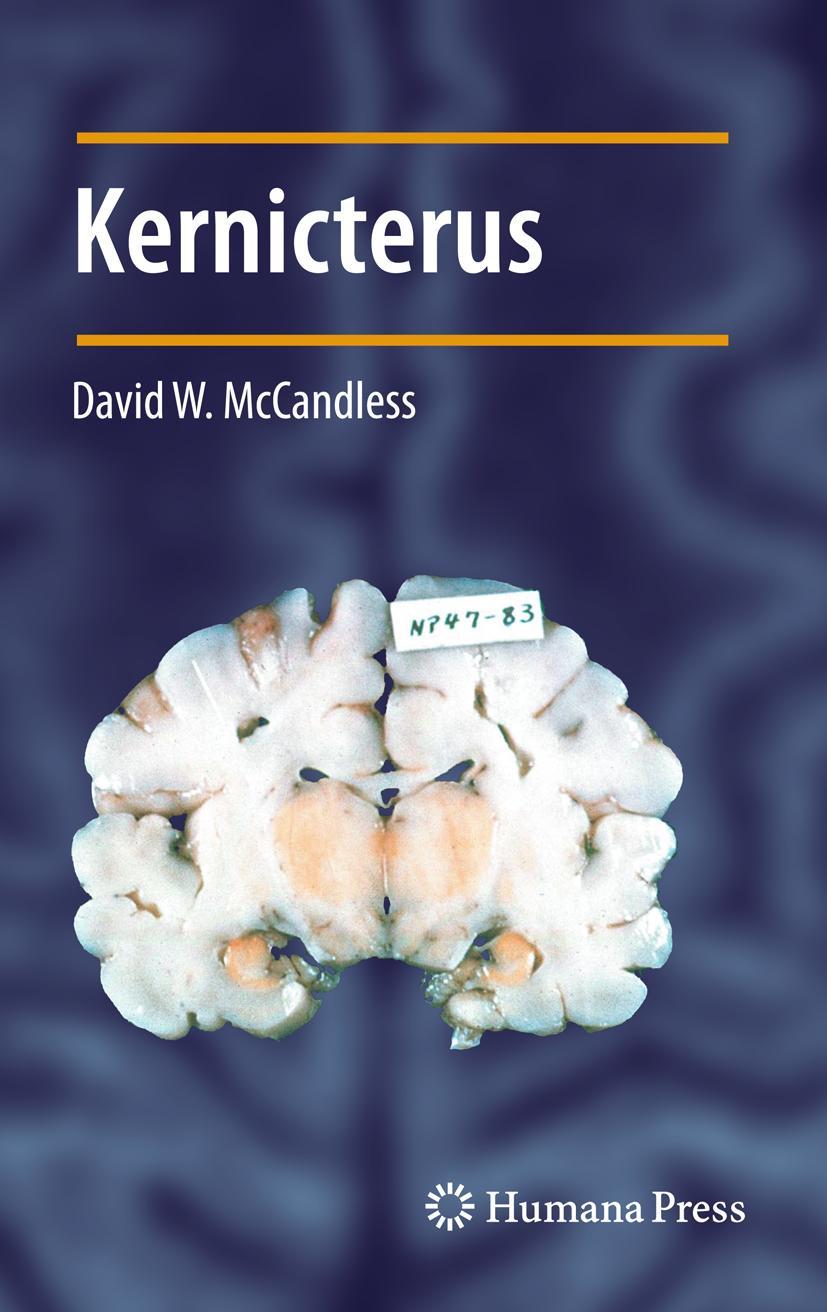 Cover: 9781617797019 | Kernicterus | David W. McCandless | Taschenbuch | xiv | Englisch