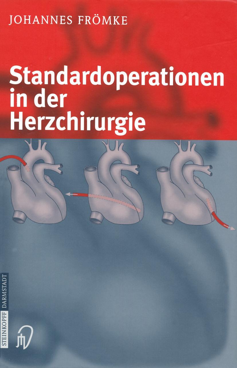 Cover: 9783642632471 | Standardoperationen in der Herzchirurgie | Johannes Frömke | Buch | x