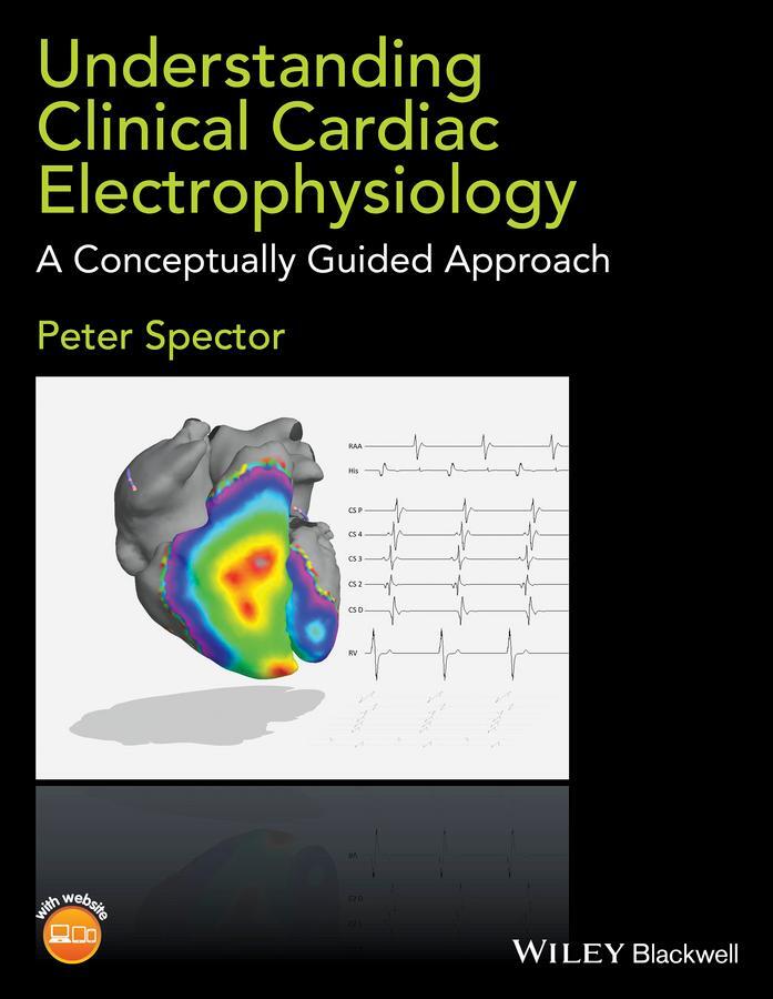 Cover: 9781118905494 | Understanding Clinical Cardiac Electrophysiology | Peter Spector