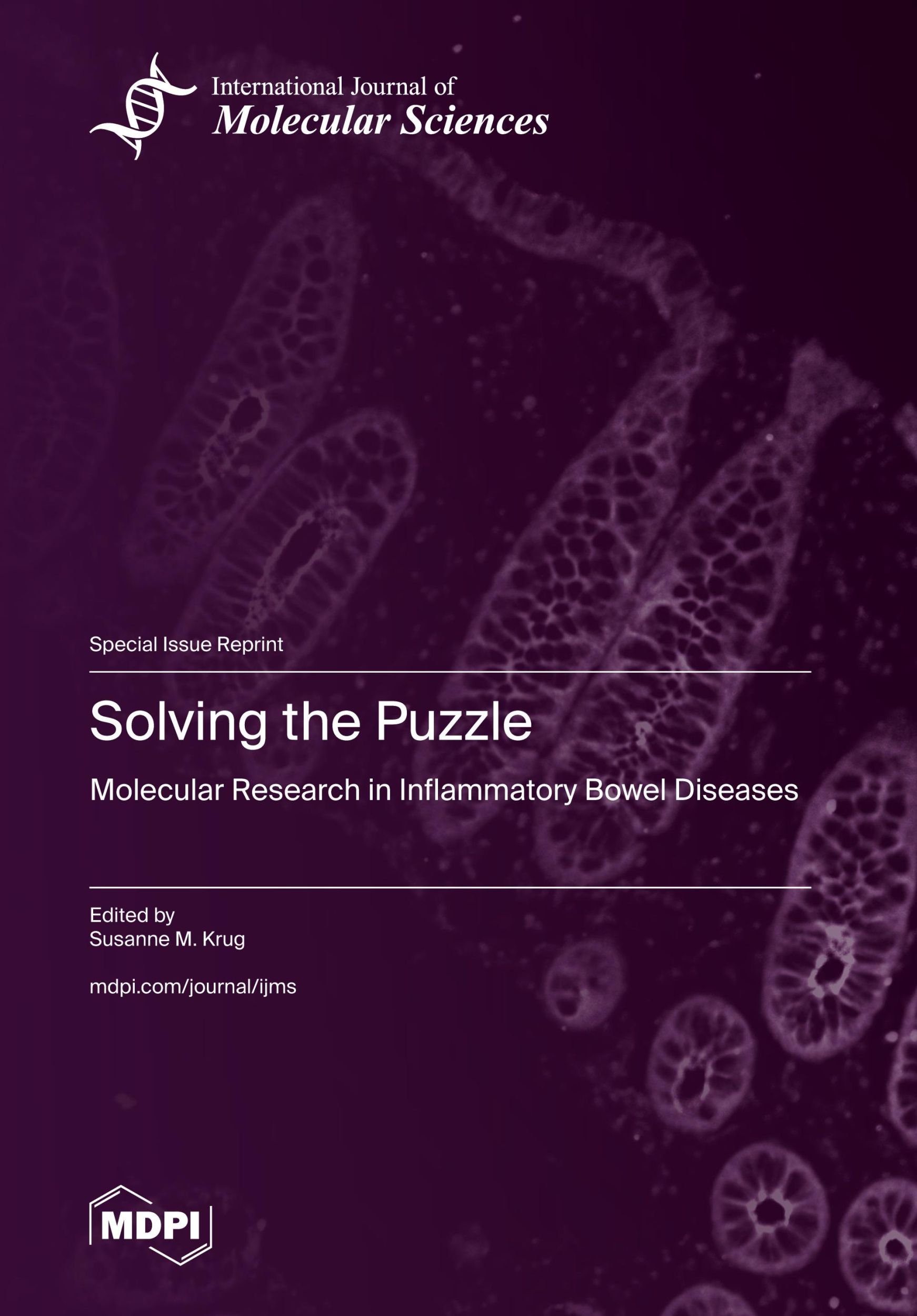 Cover: 9783036598642 | Solving the Puzzle | Molecular Research in Inflammatory Bowel Diseases