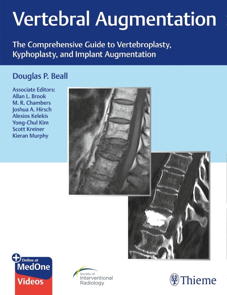 Cover: 9781684200153 | Vertebral Augmentation | Douglas P. Beall | Bundle | 1 Download | 2020