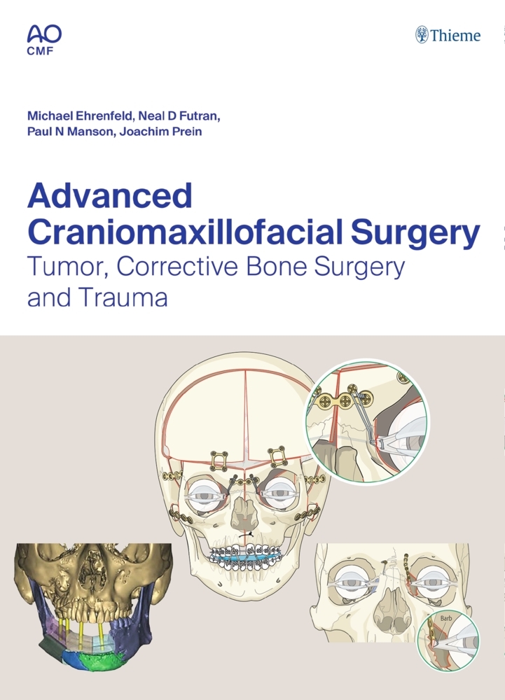 Cover: 9783132428393 | Advanced Craniomaxillofacial Surgery | Michael Ehrenfeld (u. a.)