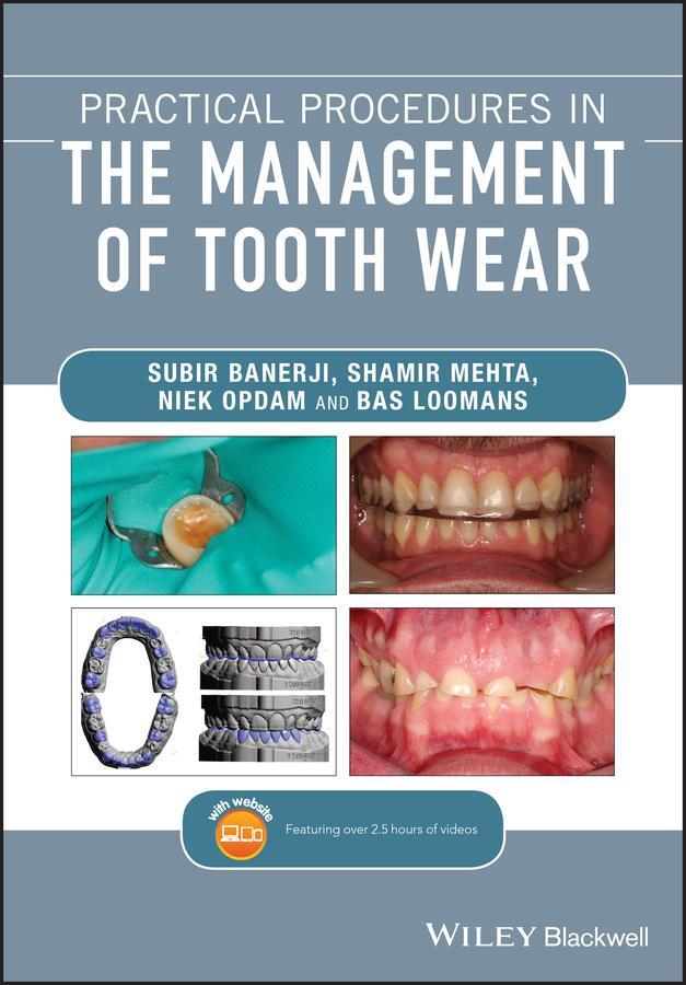 Cover: 9781119389866 | Practical Procedures in the Management of Tooth Wear | Banerji (u. a.)