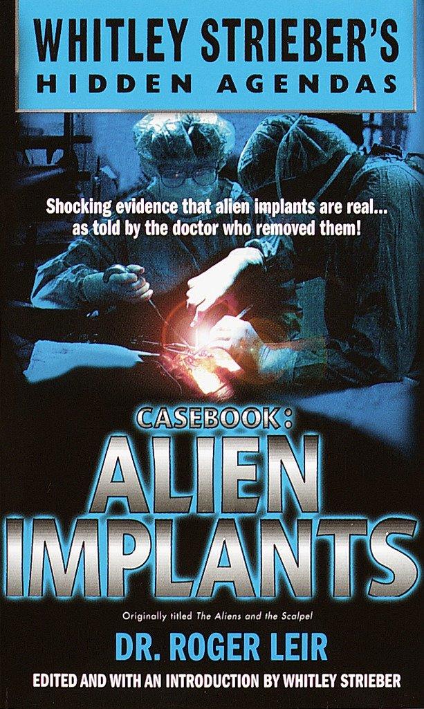 Cover: 9780440236412 | Casebook: Alien Implants | Roger Leir | Taschenbuch | Englisch | 2000