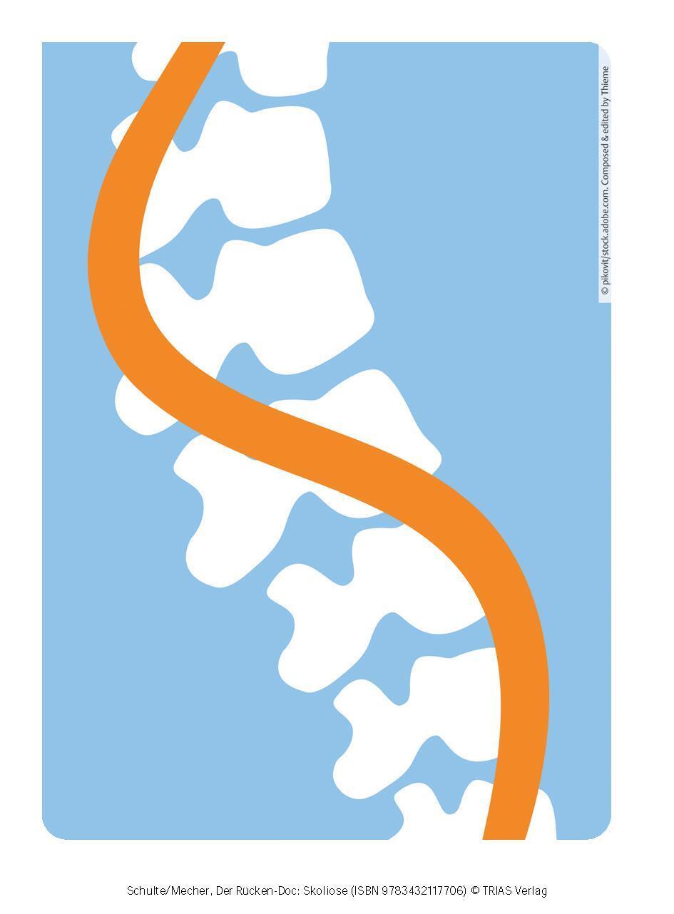 Bild: 9783432117706 | Der Rücken-Doc: Skoliose | Tobias L. Schulte (u. a.) | Taschenbuch