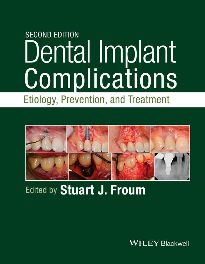 Cover: 9781118976456 | Dental Implant Complications | Etiology, Prevention, and Treatment