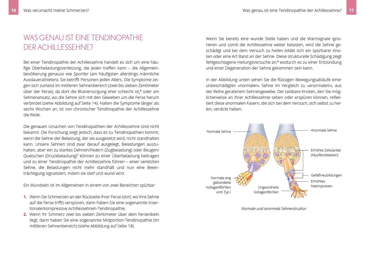 Bild: 9783742313683 | Beschwerden der Achillessehne selbst behandeln | Paula Clayton | Buch