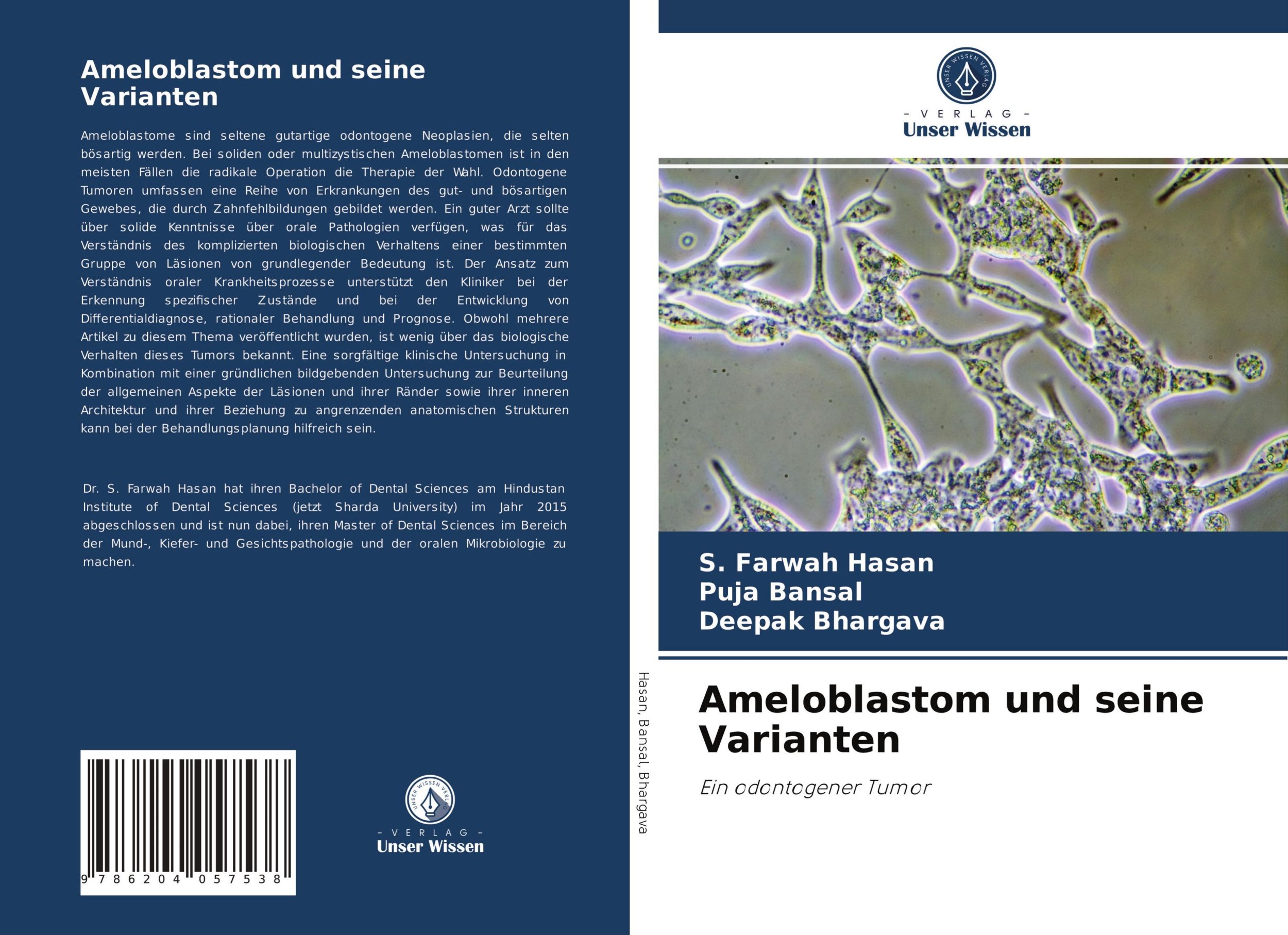 Cover: 9786204057538 | Ameloblastom und seine Varianten | Ein odontogener Tumor | Taschenbuch