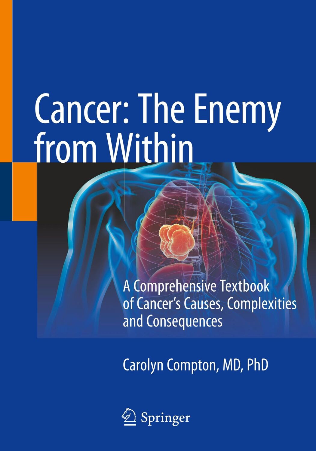 Cover: 9783030406530 | Cancer: The Enemy from Within | Carolyn Compton | Taschenbuch | x