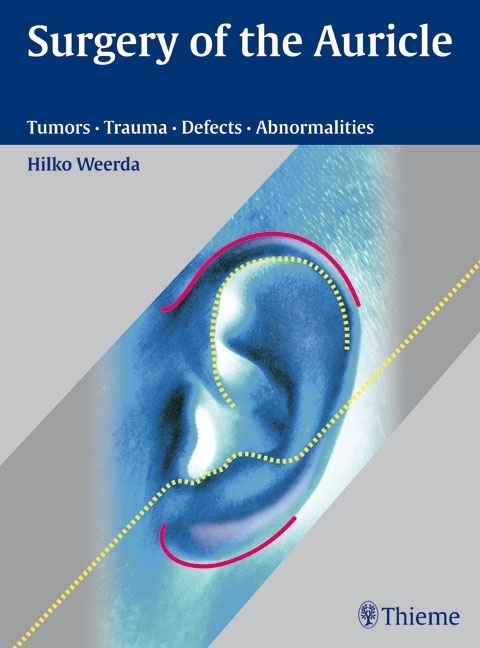 Cover: 9783131394118 | Surgery of the Auricle | Tumors-Trauma-Defects-Abnormalities | Weerda