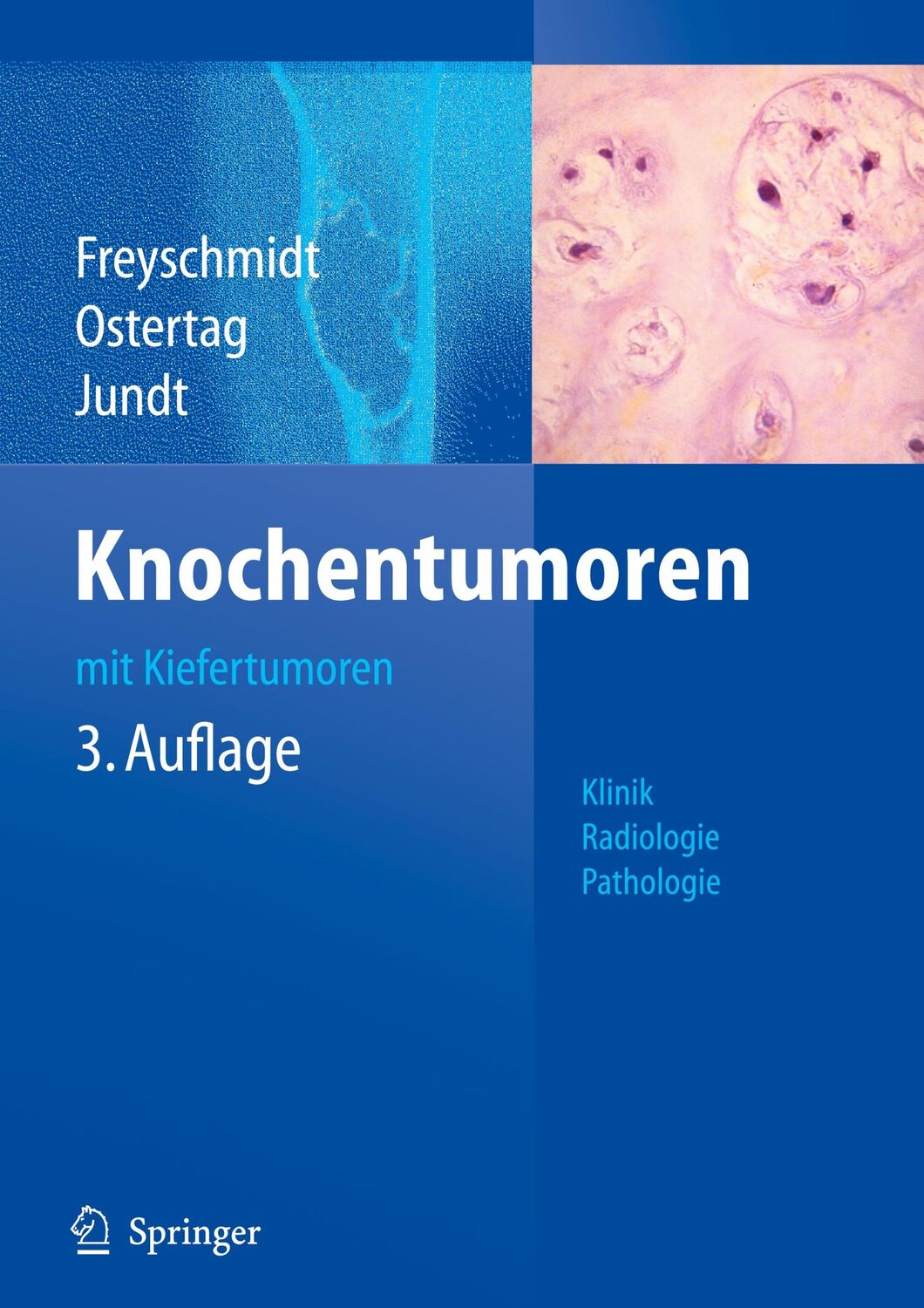 Cover: 9783540751526 | Knochentumoren mit Kiefertumoren | Klinik - Radiologie - Pathologie