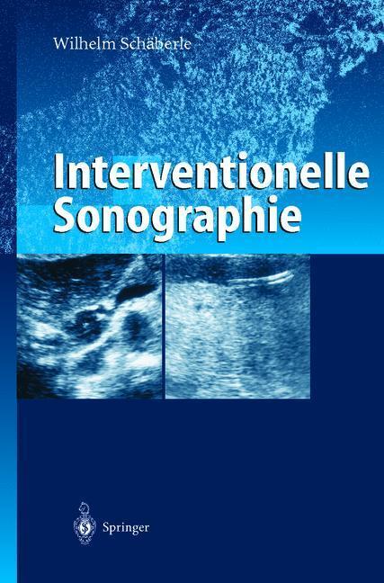 Cover: 9783642640667 | Interventionelle Sonographie | Wilhelm Schäberle | Taschenbuch | xii