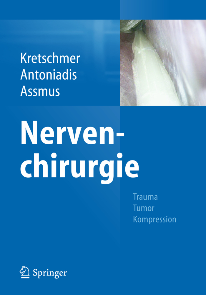 Cover: 9783642368943 | Nervenchirurgie | Trauma - Tumor - Kompression | Kretschmer (u. a.)