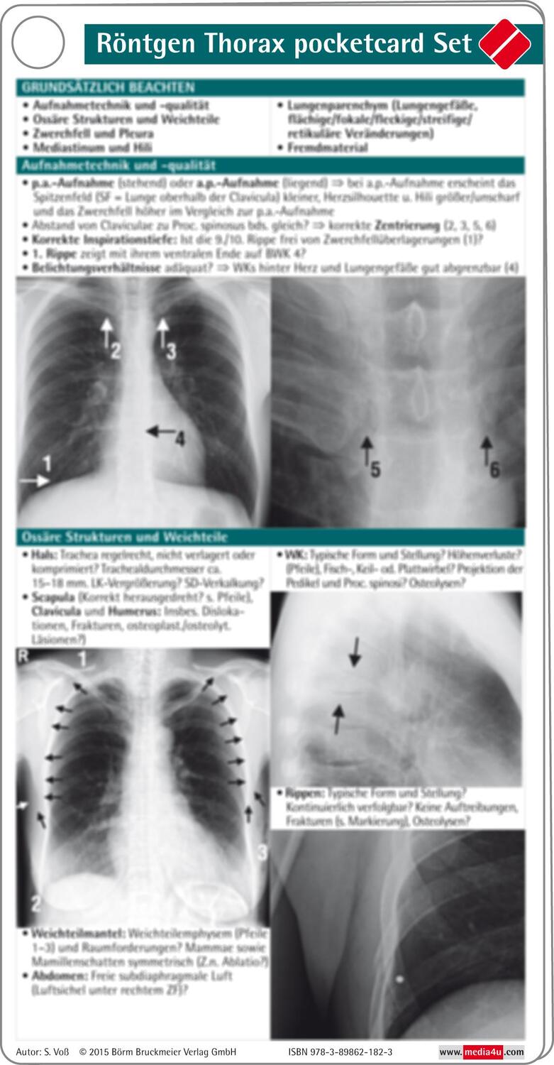 Cover: 9783898621823 | Röntgen Thorax pocketcard Set | S. Voß | Buch | pocketcards | 4 S.