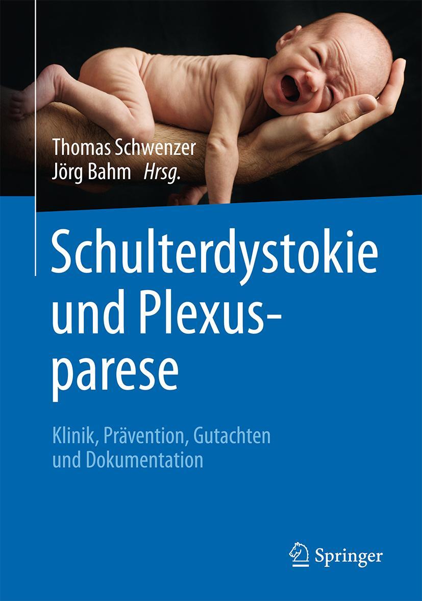 Cover: 9783662487860 | Schulterdystokie und Plexusparese | Thomas Schwenzer (u. a.) | Buch