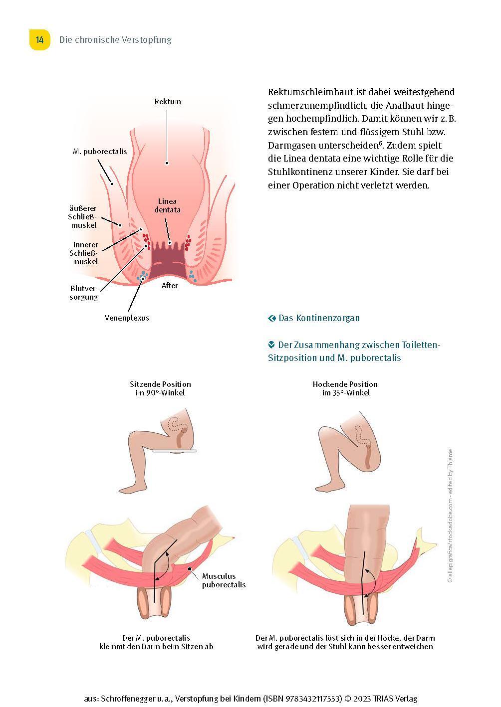 Bild: 9783432117553 | Verstopfung bei Kindern | Yvonne Schroffenegger (u. a.) | Taschenbuch