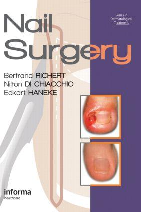 Cover: 9780415472333 | Nail Surgery | Bertrand Richert (u. a.) | Buch | Englisch | 2011