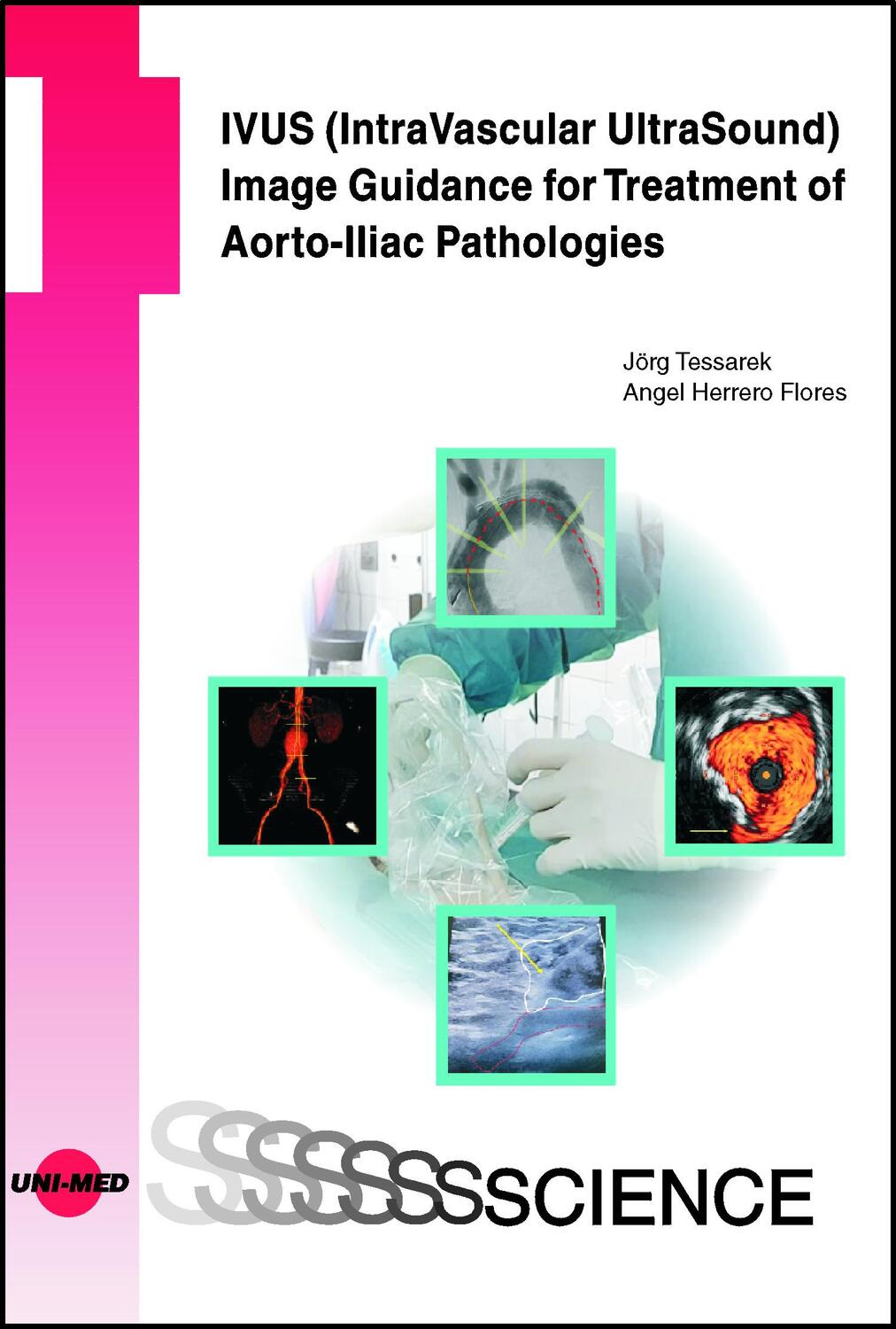 Cover: 9783837416640 | IVUS (IntraVascular UltraSound) Image Guidance for Treatment of...