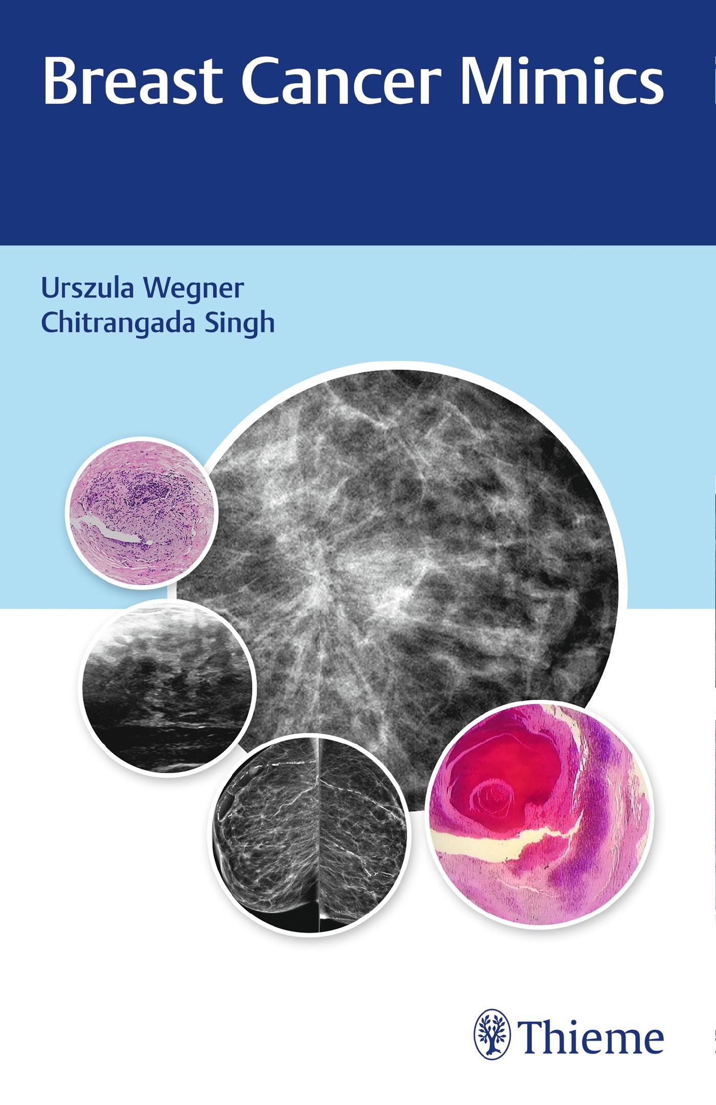 Cover: 9789388257947 | Breast Cancer Mimics | Urszula Wegner (u. a.) | Taschenbuch | 224 S.