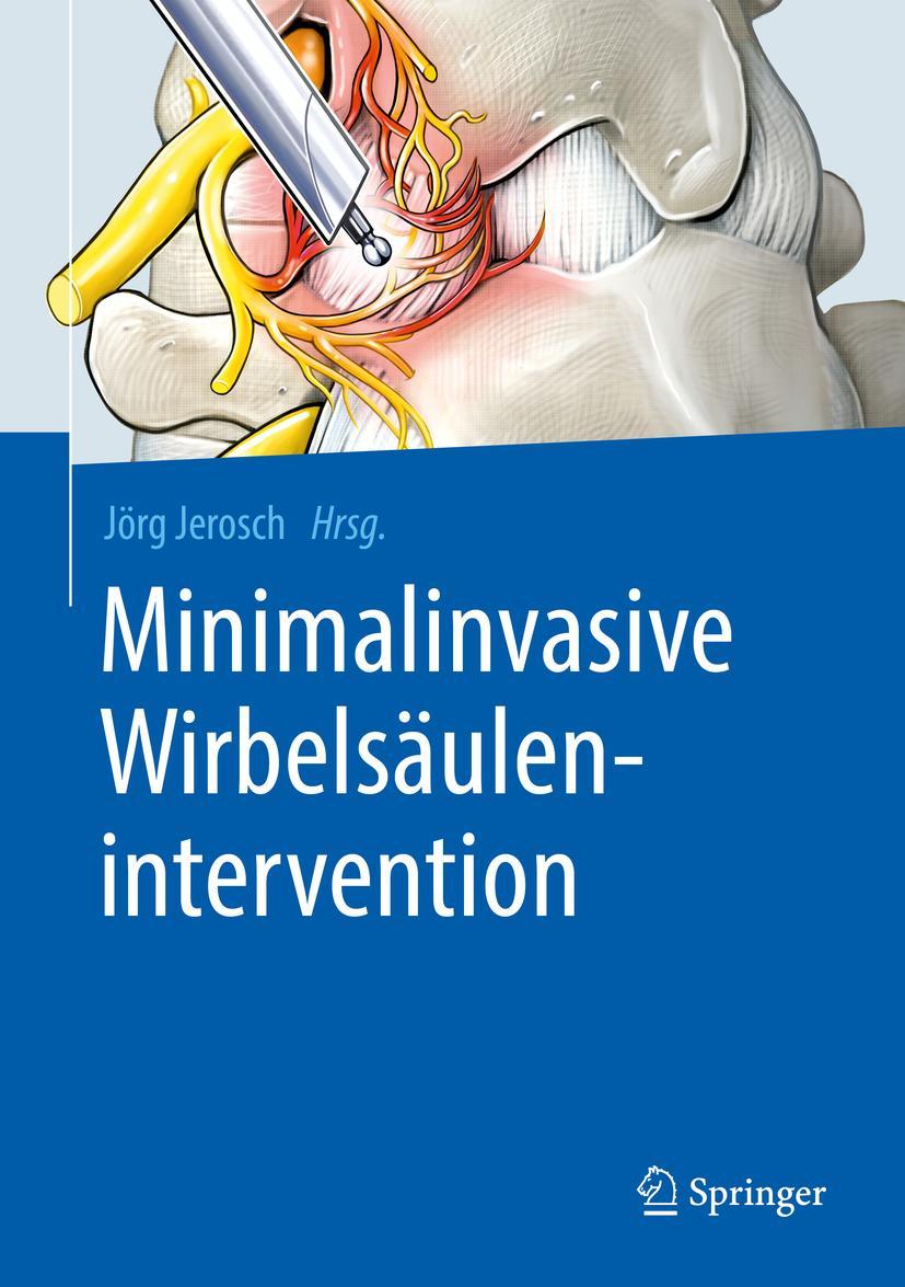 Cover: 9783662580936 | Minimalinvasive Wirbelsäulenintervention | Jörg Jerosch | Buch | xx