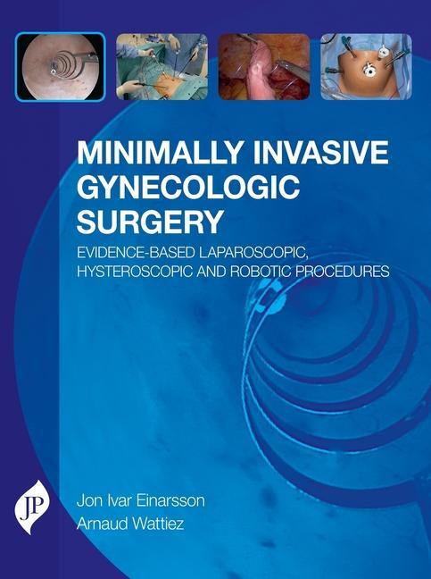 Cover: 9781909836099 | Minimally Invasive Gynecologic Surgery: Evidence-Based...