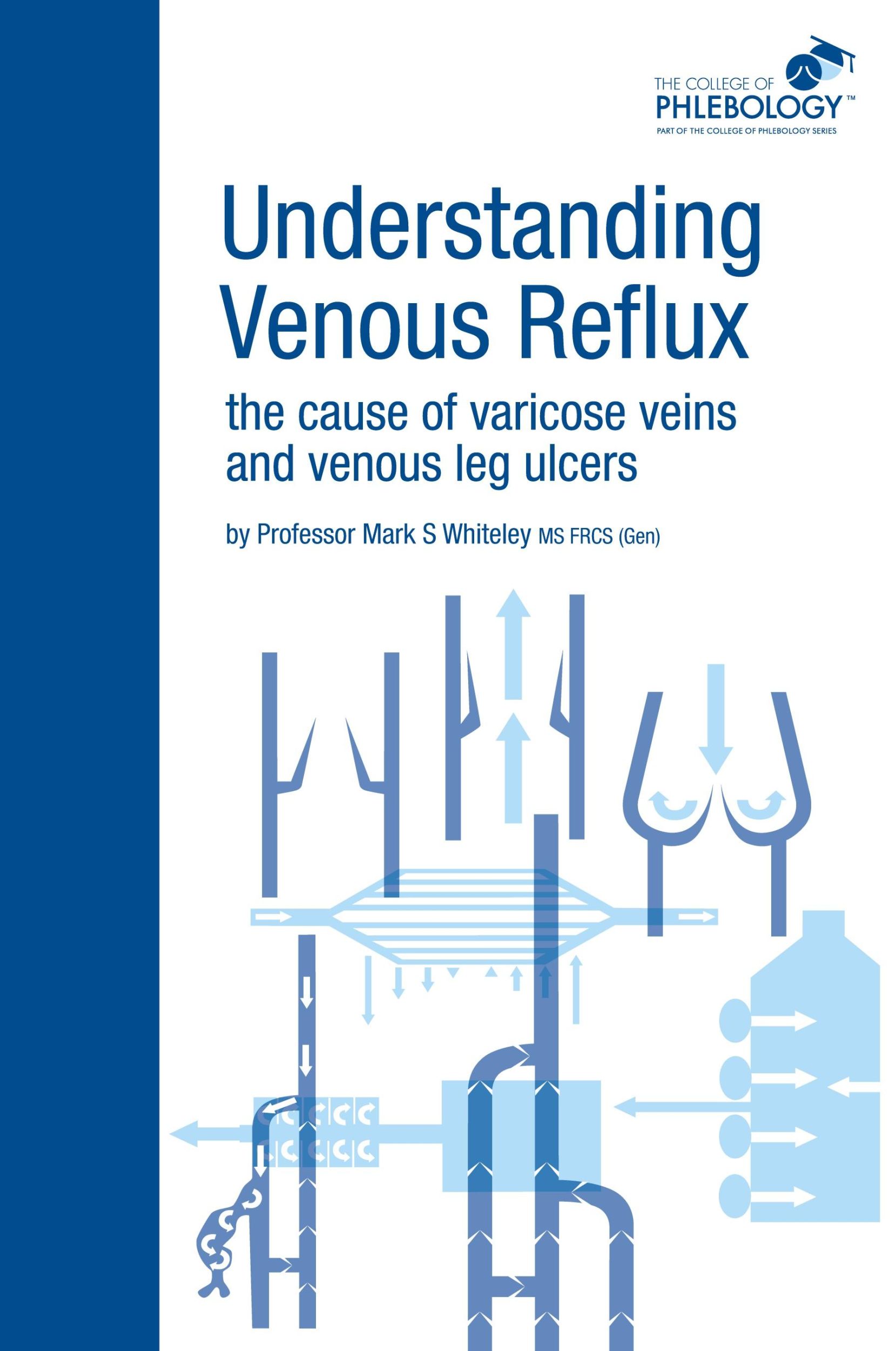 Cover: 9781908586001 | Understanding Venous Reflux the Cause of Varicose Veins and Venous...