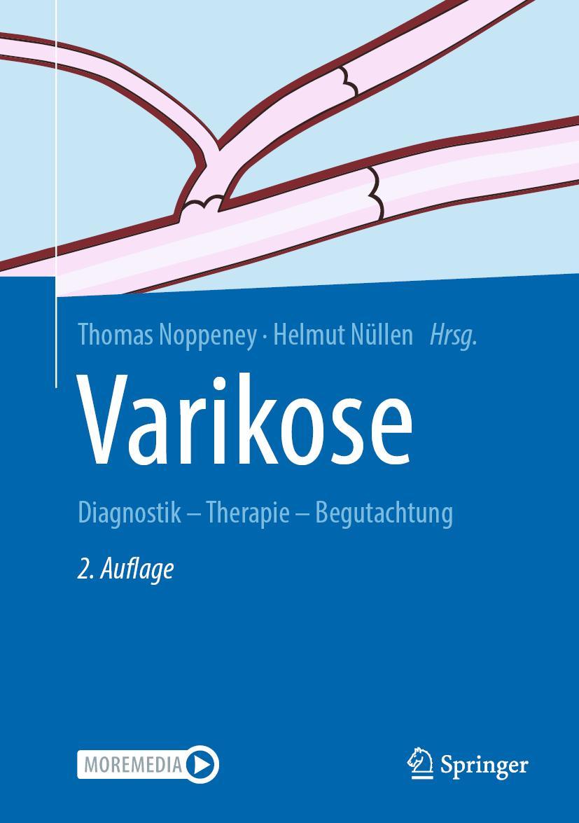 Cover: 9783662591161 | Varikose | Diagnostik - Therapie - Begutachtung | Noppeney (u. a.)