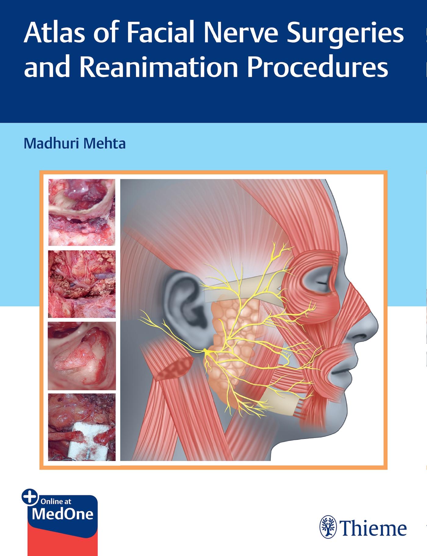 Cover: 9789392819131 | Atlas of Facial Nerve Surgeries and Reanimation Procedures | Mehta