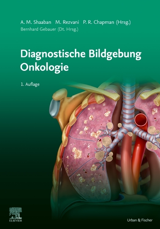 Cover: 9783437240317 | Diagnostische Bildgebung Onkologie | Shaaban Akram M. | Buch | XX